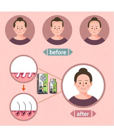 Ginger Plant Extract Anti-Hair Loss Hair Shampoo Ginger Hair Regrowth Shampoo Anti Hair Loss Ginger Shampoo (Color : 1Box) - Buy Online on GoSupps.com