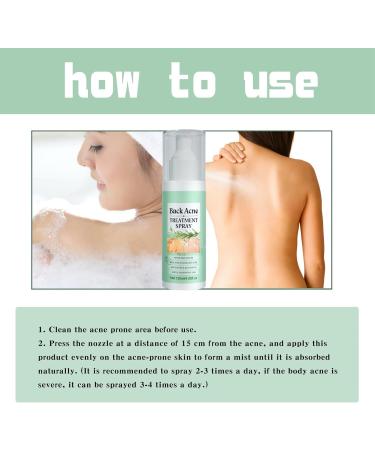 Back Acne Treatment Spray Acne Treatment Spray Acne Moisturiser for Back Body Body Acne Treatment Acne Back Treatment Back Spray Acne Body Acne Spray Back Acne Treatment Acne Body Spray 120ml - Buy Online on GoSupps.com