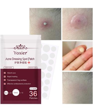 Acne Dressing Spot Patch Acne Paste Transparent Pimple Patch Breathable Painless Acne Treatment Gel Patch Skin Care Absorb Pus Rapid Healing Effective Antibacterial Protection 36 Patches - Buy Online on GoSupps.com