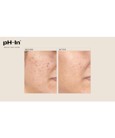 3 Step Healthy Skin System | Achieve Radiant Skin | International Shipping Available - Buy Online on GoSupps.com