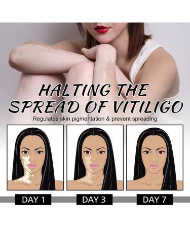 (Two Packs)Psoralea Corylifolia Skin Revitalizing Balm - External Use Tone Repair Cream for Uneven and White Spot Care - Buy Online on GoSupps.com