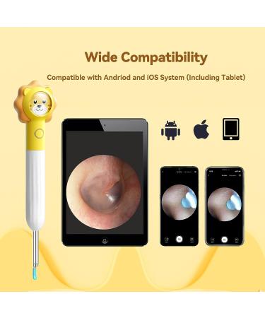 8MP HD Ear Wax Removal Tool with Camera and 6 LED Lights - Earwax Removal Kit for Kids and Adults - Ear Camera for iPhone, iPad, Android Phones - Q3 (Yellow with Kits) - Buy Online on GoSupps.com