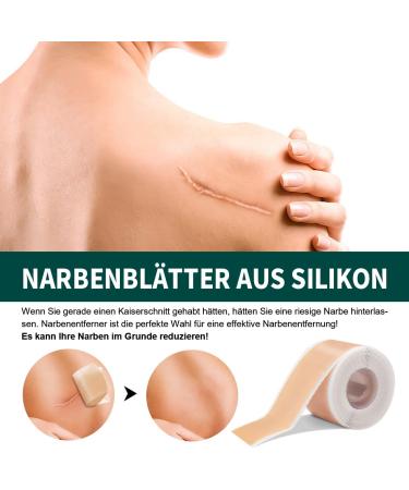 Silicone Scar Sheets (4cm x 150cm) | Professional Treatment for C-Section Burns Keloids & Acne Medication-Free Solution - Buy Online on GoSupps.com