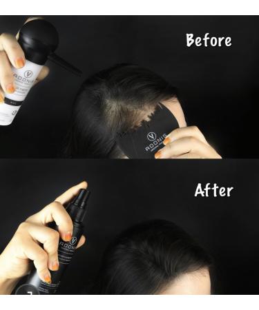 Buy COMPLETE SET 5-in-1 ADONIS Hair Fiber Kit - All Natural Keratin Hair Fibers for Thinning Hair | Fast International Shipping - Buy Online on GoSupps.com