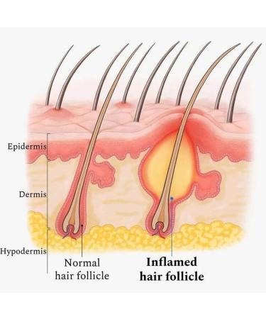 siduytin Adults Dense Hair Essential Oil Adults Natural Ingredient Regrowth Anti-loss Moisturizing for Essence Haircare - Buy Online on GoSupps.com