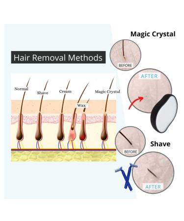 Magic Crystal Hair Eraser - Fast Painless Hair Removal for Men & Women | Smooth Silky Skin Anywhere - Gold Edition - Buy Online on GoSupps.com