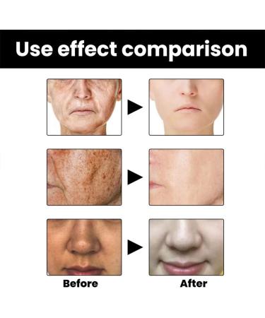 Melanin Correcting Face Serum Dark Spot Correcting Serum Moisturizing Repairing Face Serum Hydrate Anti-Wrinkle Facial Essence Collagen Face Serum Firms and Rejuvenates Skin - Buy Online on GoSupps.com