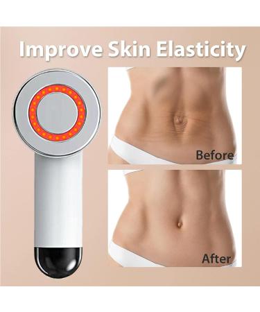 MWSHIYUQING Electric Anti Cellulite Cupping with Ultrasonic Wave Anti Cellulite Smoother Belly Anti Cellulite Massage for Human Skin - Buy Online on GoSupps.com