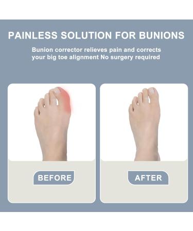 Bunion Corrector for Men | Adjustable Splint for Big Toe Discomfort | Comfortable Left/Right Fit | Large Size - Buy Online on GoSupps.com