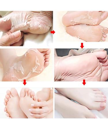 Adawd Foot Peeling Mask - Moisturizing Treatment Socks for Baby Soft Feet Removes Dead Skin & Repairs Cracked Heels - 1 Piece - Buy Online on GoSupps.com