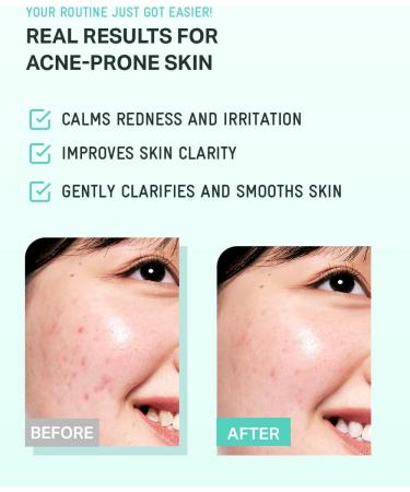 BRING GREEN Tea Tree CICA Soothing Toner | Mild Daily Skincare Routine for Cooling and Hydrating Effect (8.5 Fl. Oz. 250ml) - Buy Online on GoSupps.com