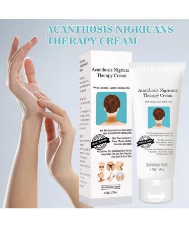 Acanthosis Nigricans Cream Whitening Cream Underarm Whitening Cream Brightening Cream Effectively Lightens Melanin Neck Ankle Knee - Buy Online on GoSupps.com