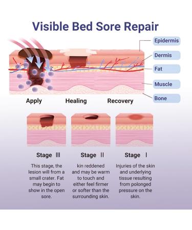 Pressure Sore Relief Healing Cream - Fast Absorption Moisturizing Formula for Wound Healing & Itch Relief | Soothing Redness & Promoting Healthy Skin - Buy Online on GoSupps.com