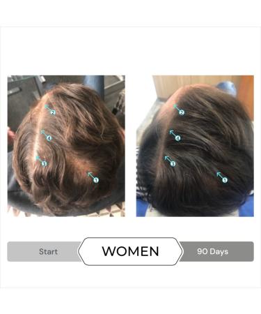 DS Laboratories Spectral.DNC-S Anti-Gray Extra Strength Serum - Hair Growth Support for Men and Women - Color Restorer and Hair Loss Treatment - 2 fl oz - Buy Online on GoSupps.com