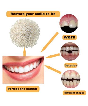 Dental Repair Kit - Temporary Teeth Replacement for Missing & Broken Teeth | Restore Your Smile Confidently - Buy Online on GoSupps.com
