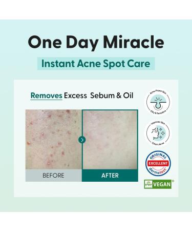 Saint Blanc Tea Tree Oil 0.7 Fl.oz - Blemish Fighting 5X Concentrated Extracts for Soothing & Sebum Control - Hypoallergenic Solution - Buy Online on GoSupps.com