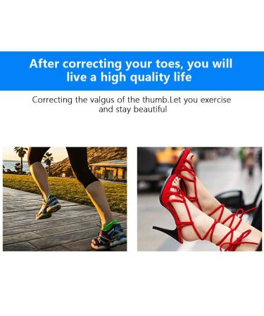 YUYTE Hallux Valgus Corrector Orthotic Braces for Bunion Alignment [Large] - Toe Separator for Men and Women - Buy Online on GoSupps.com