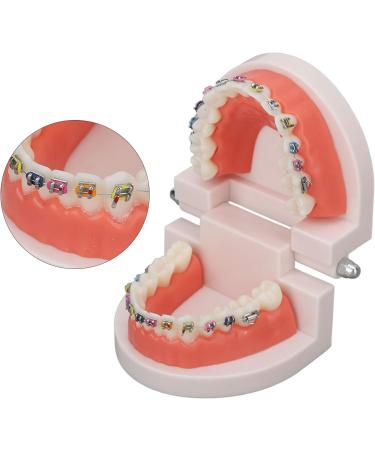 Orthodontic Tooth Model with Metal Brackets - Ideal for Teaching & Research in Laboratories | International Shipping - Buy Online on GoSupps.com