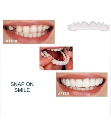 Instant Perfect Smile Clip-On Veneers - 5 Piece Cosmetic Teeth Set | Pain-Free Braces & Whitening Alternative - Buy Online on GoSupps.com