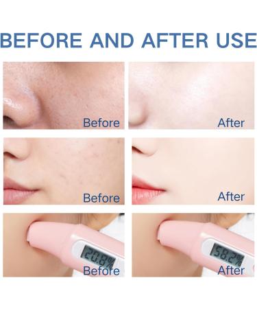 Face gel - Silver Gel Face Cream - Repair Face Cream for Women - Dark Spot Remover for Face - Moisturizing Night Face Moisturizer for Women - Smooth Skin Gel Moisturiser 80g - Buy Online on GoSupps.com