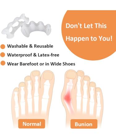 KIYOKI Toe Separators Bunion Corrector for Women/Men - Foot Alignment Spacers for Bunions, Hammertoes, Plantar Fasciitis - Hallux Valgus Relief - Medium - Buy Online on GoSupps.com