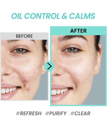 COXIR Tea Tree Pore and Sebum Toner (150 ml / 5.07 oz) Volcanic Water Toner Oil Balance Pore Minimiser Sebum Control - Buy Online on GoSupps.com