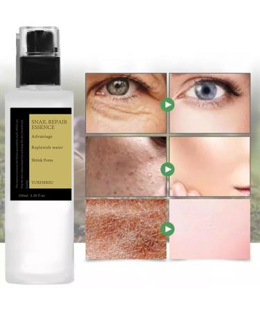 Snail Mucin Essence Snail Mucin Skin Care Sets &Kits Snail Mucin Face Creamf or Anti Wrinkle Hydrating Hyaluronic AcidSerum Niacinamide Serum Smooth Fine Lines &Face Moisturiser(Cream+Essence Set) - Buy Online on GoSupps.com