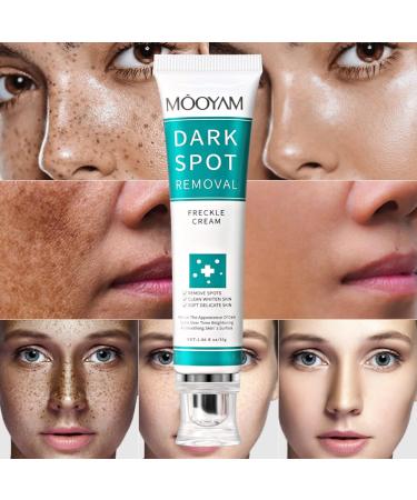 Dark Spot Correcting Serum - Best Dark Spot Remover for Age Spots Sun Spots & Freckles - 30g Body Cream - Buy Online on GoSupps.com