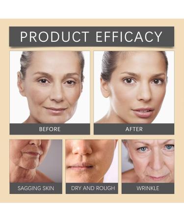 Bee Venom Cream Wrinkle Removal Cream Firming Moisturizing Lifting Skin Suitable for the Face and Neck - Buy Online on GoSupps.com