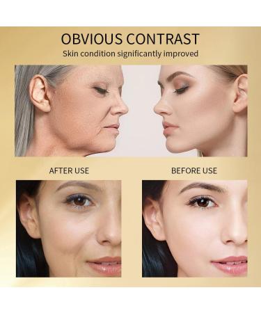 24K Gold Niacinamide Anti-Wrinkle Serum Concentrate Refines Pores & Brightens Skin Hyaluronic Acid & Gold Foil - Buy Online on GoSupps.com