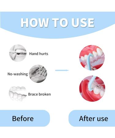 4PCS YAFIYG Clear Aligner Remover Tool - Hygienic Grabber for Aligner Case/Dental Carry Case - Buy Online on GoSupps.com
