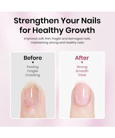 SUPWEE Nail Salon Nail hardener treatment for weak and brittle nails nail strengthening growth activator strengthening groove filler base coat repair nail care 16 ml - Buy Online on GoSupps.com