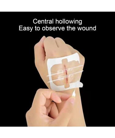 Zip Stitch: Painless, Waterproof Skin Closure Device for Wound Care - Noninvasive Sutures Bandaids - Buy Online on GoSupps.com