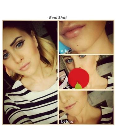 Apple Lip Plumper Device Enhancer - Quick Beauty Lip Enhancer & Trainer for Girls (Green) - Buy Online on GoSupps.com