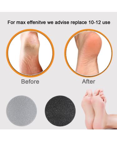 25 Pack Replacement Pads for Pedi Vac Callus Remover - Exfoliate Cracked Heels and Dead Skin - Includes 20 Grind Head Pads and 5 Sponge Rings - With Clean Brush - Buy Online on GoSupps.com