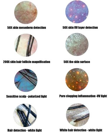 13inch Skin Scalp Detector Hair Skin Detector for Random Skin Hair Scalp Analysis MultiFunctional Rechargeable Hair Follicle Skin Analyser Machine(US) - Buy Online on GoSupps.com