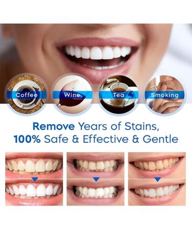 Limetown Teeth Whitening Essence - Effective Whitening Pen for Hard-to-Reach Areas | 1/2 Pack - Brighten Your Smile! - Buy Online on GoSupps.com