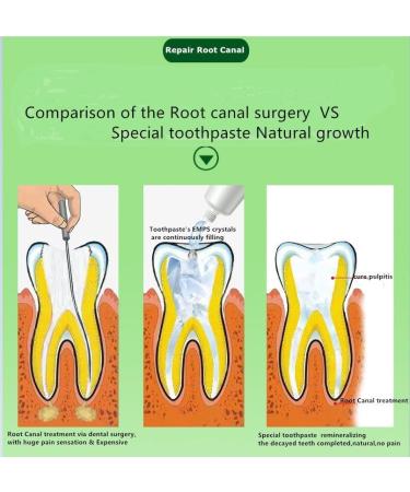 Spearmint Gum Care Toothpaste for Root Canal Treatment - 3.5 Oz | Treat Pulpitis & Periodontitis Prevent Teeth Root Fracture | Optimal for Teens & Adults - Buy Online on GoSupps.com
