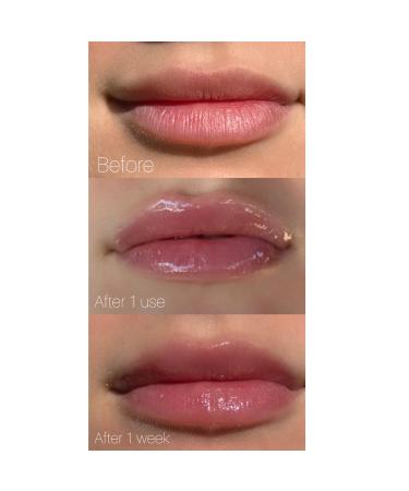 YUGLO Multi-Peptide Lip Plumping Treatment Youthful Lip Gloss & Moisturizer for Women Repair Chapped Lips with Watermelon Flavor - Buy Online on GoSupps.com