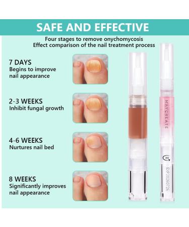 ACWOO Fungal Nail Treatment Set - 3PCS Anti Fungal Pen, Cuticle Oil, Nail File - Natural Plant Ingredients - Treat, Repair & Prevent Fungal Nail Infections - Buy Online on GoSupps.com
