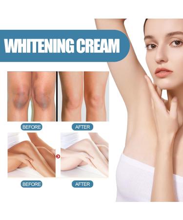 Underarm Whitening Cream Natural Armpit Whitening Cream Effective Body Skin Lightening & Brightening Cream for Knees Elbows Sensitive & Private Areas Whitens Nourishes Restores Skin - Buy Online on GoSupps.com