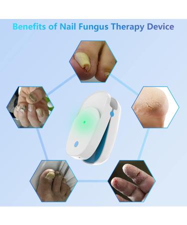 Ikeen Nail Fungus Treatment Device | FDA Approved Portable Cold Laser Therapy for Finger & Toe Care | Painless & Rechargeable Healing Solution - Buy Online on GoSupps.com