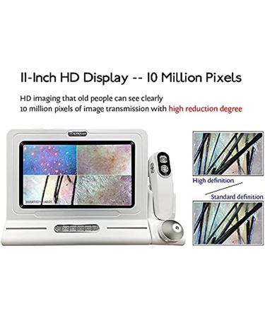 Scalp Detector 11 Inch Skin Diagnostic Hair Analyzer with LCD Display Screen and 50X/200X Lens Skin Diagnostic Scanner System for Home - Buy Online on GoSupps.com