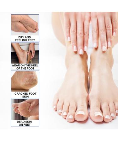 Fengyang Urea Foot Care Cream Foot Balm Stick Urea Foot Balm Stick makes the skin soft for elbows knees feet and hands - Buy Online on GoSupps.com