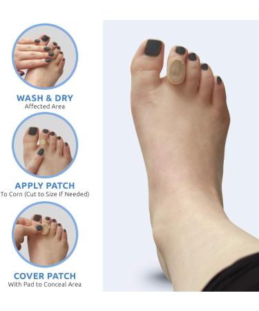Comfort Zone Corn Removers Medicated Patches  Effective Corn Removal Pads with Salicylic Acid  18 Medicated Patches and 18 Protective Pads - Buy Online on GoSupps.com