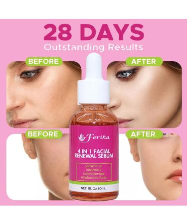 4 in 1 Facial Renewal Serum - Vitamin C E Hyaluronic Acid & Niacinamide | Ultra Regenerating Treatment for Radiant Skin - Buy Online on GoSupps.com