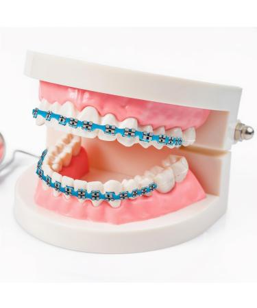 Fake Braces Temporary Clip on Teeth with Brackets & Wire Temporary Braces Suitable for Orthodontists to Explain and Practice for Dental Students - Brackets Falsos Para Dientes(Light Blue) - Buy Online on GoSupps.com