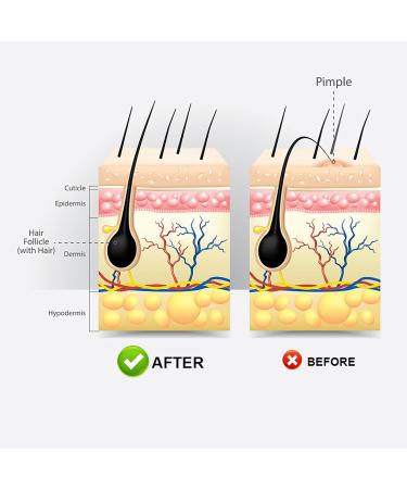 WJnflQN Scalp Soothing Gel 20 g light gel soothing scalp care for daily and seasonal care at home on the go women men - Buy Online on GoSupps.com