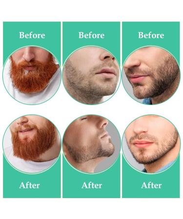 Beard Templates & Stencils - 2-Piece Beard Contour Set for Perfect Styling | Beard Care Tools for Full & 3-Day Beards - Buy Online on GoSupps.com