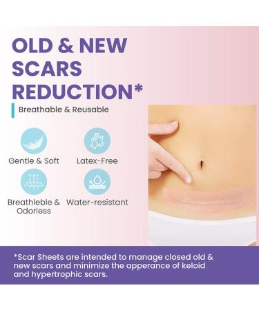 Silicone Scar Sheets for Keloid, C-Section, Tummy Tuck - Surgical Scar Treatment Gel Bandage - Buy Online on GoSupps.com